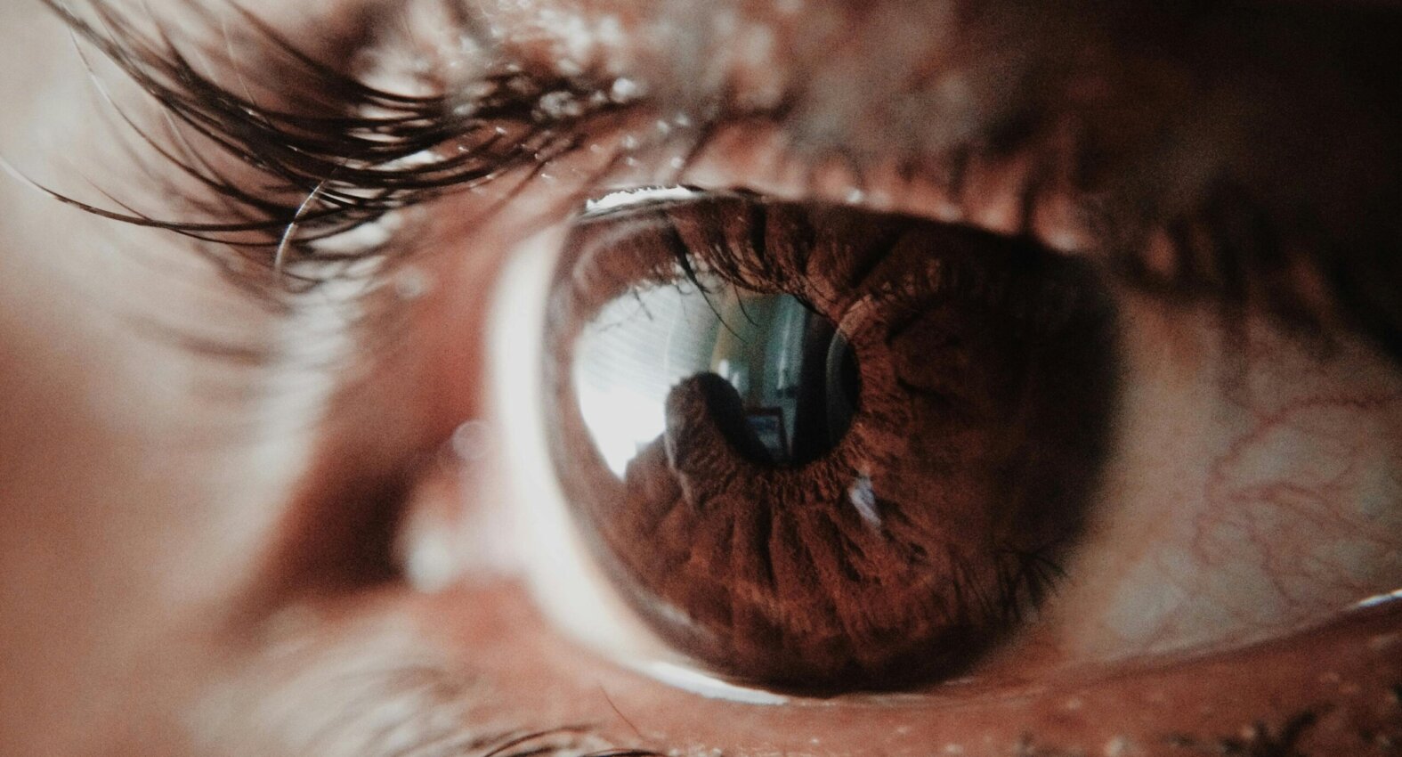 Vision 01